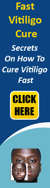 Cure Vitiligo Fast